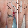 Image 2: Up to 86% Off on Tattoo Removal at Sure Thing Studio