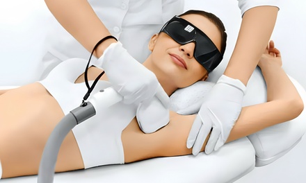 1 séance découverte d'épilation au laser de 15 minutes sur petites zones (aisselles ou maillot classique) - Dream Beauty