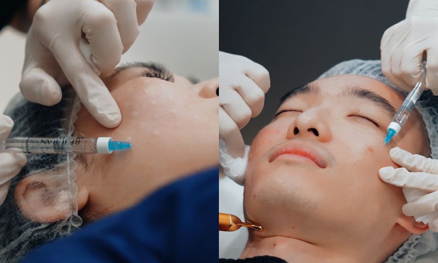 Image 3: 1, 2, or 3 Full Face & Neck Profound RF Microneedling + Rejuran Healer