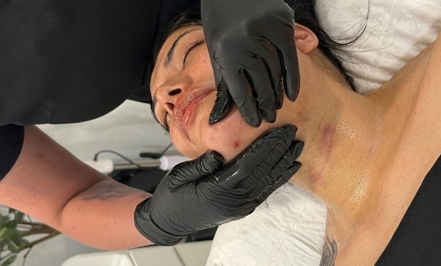Image 2: 60-Min Lymphatic Drainage: Post-Op, Wellness, or Face/Chin Recovery