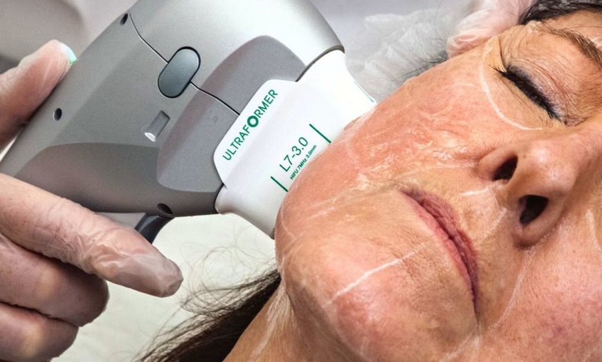 Image 1: Lift and Rejuvenate with HIFU Face, Neck, Chin Lift and More!