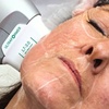 Image 1: Lift and Rejuvenate with HIFU Face, Neck, Chin Lift and More!