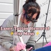 Image 2: Up to 60% Off on Tattoo Removal at Hot Mess