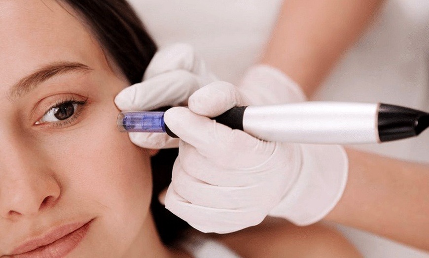 Image 3: Sesiones de rehidratación de labios, Dermapen facial y exosomas