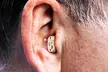 Digital Invisible In-Ear Hearing Aid - Image 3