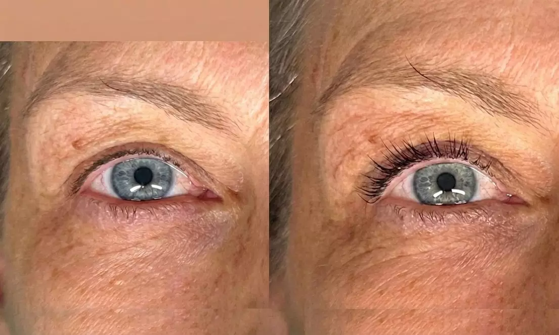 Regard intense : brow lift, extensions de cils naturel ou volume russe