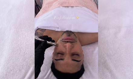 Custom Facial With Microdermabrasion & LED Light Therapy - 55 Minute - The Skynn Bar