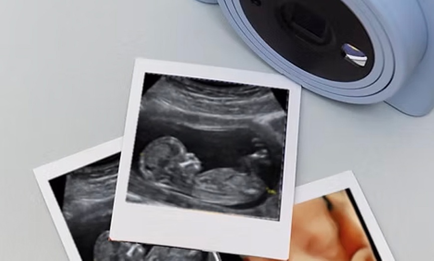 Image 2: Capture Precious Moments: 2D Early Pregnancy Scan