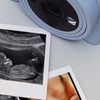 Image 2: Capture Precious Moments: 2D Early Pregnancy Scan