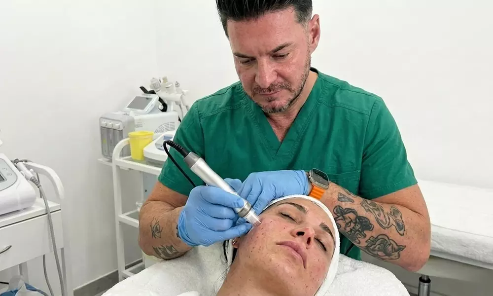 Fractional RF Microneedling Skin Rejuvenation Treatment
