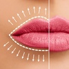 Image 1: Get a Half Syringe or One of the Dermal Fillers