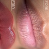 Image 7: Perfect Lips: Semi-Permanent Blush, Lip Liner & Dark Lip Correction