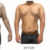 Image 4: Precision Slim Laser Fat Loss & Skin Tightening, Your Sculpt Studio DC