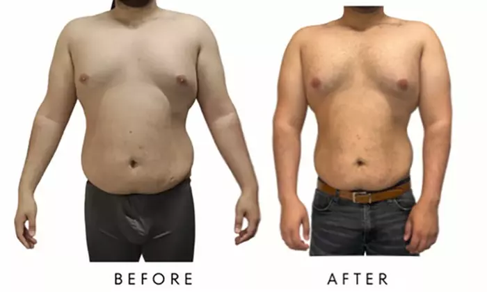 Precision Slim Laser Fat Loss & Skin Tightening, Your Sculpt Studio DC