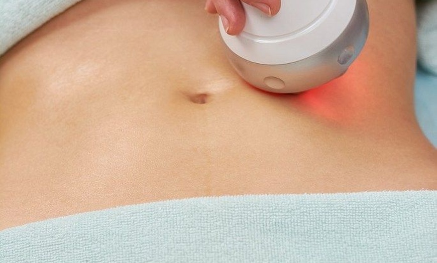 Image 6: Youthful Radiance with One HIFU Session for Body, or Full Face & Neck