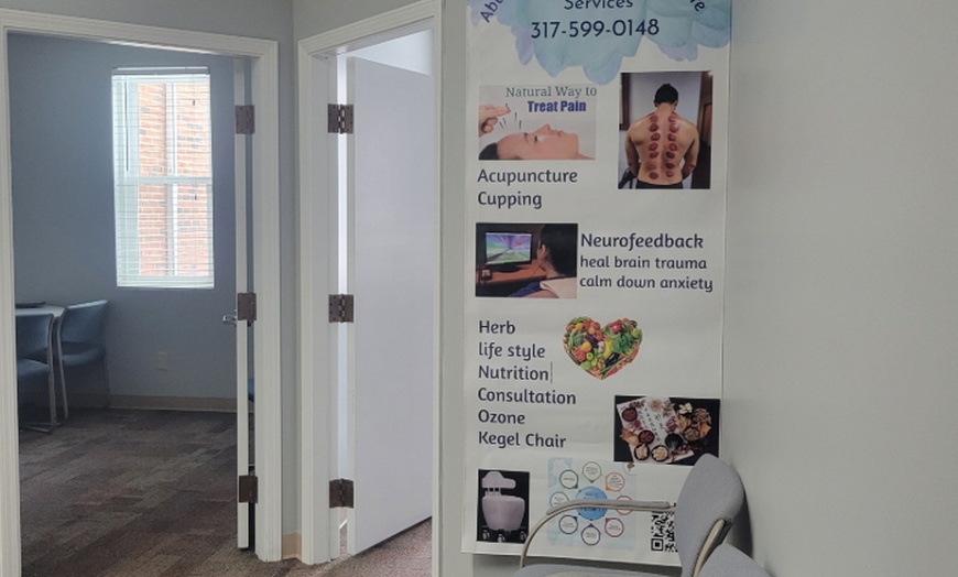 Image 4: Boost Wellness with One or Two Acupuncture & Cupping Treatments