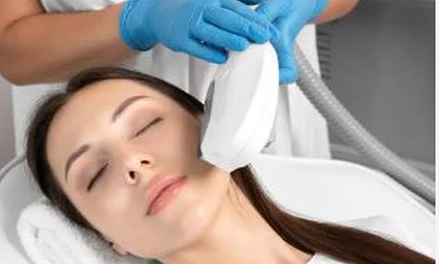 Image 2: Sessions of IPL Photo Facial at NiaSol Anti-Aging & Laser Clinic