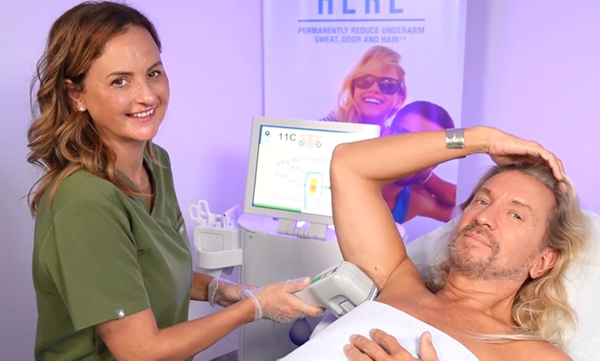 Image 1: Effective underarm sweat reduction with MiraDry sessions