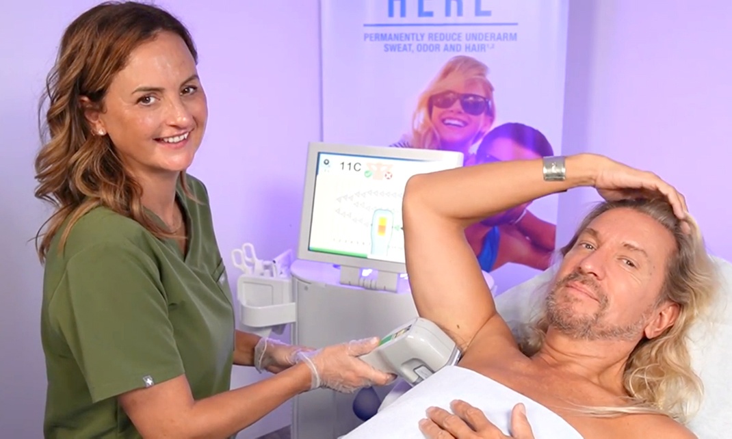 Effective underarm sweat reduction with MiraDry sessions