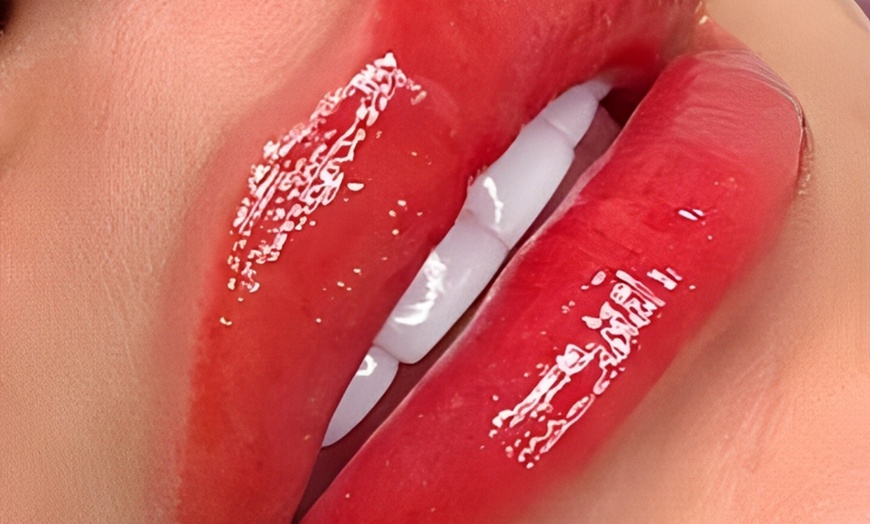 Image 9: 1 o 2 sesiones de rehidratación de labios o microlifting facial para 1