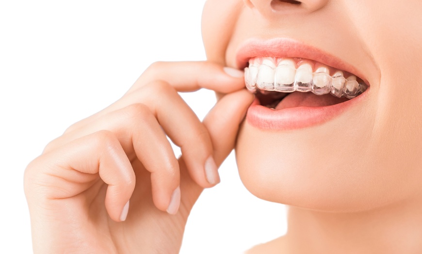 Image 3: Brackets con revisiones, estudio completo u opción  de escaneo 3D