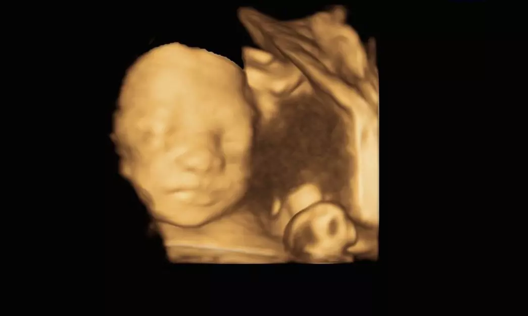Capture Baby's First Moments with 3D/4D Ultrasound