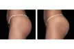 Up to 56% Off on Electrical Muscle Stimulation at TS3 Hair Salon And Spa - Second Medium