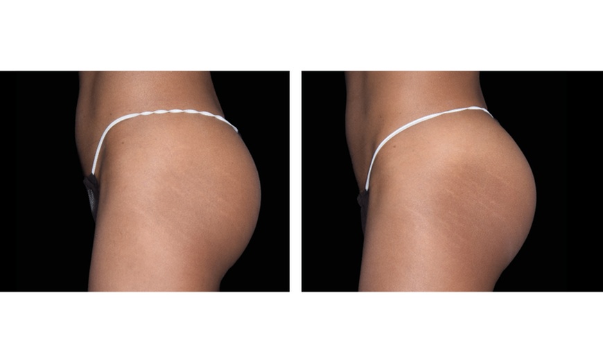 Image 5: Up to 56% Off on Electrical Muscle Stimulation at TS3 Hair Salon And Spa