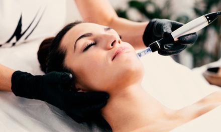 Microneedling - 1 Sessions - Skin remedy clinic