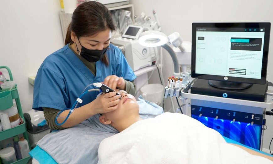 Image 6: Advanced IPL/Photofacial Stellar M22 for Clearer, Radiant Skin