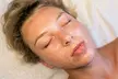 Enhance Your Glow with One, Two, Three or Four Professional Grade Pro Chemical Peels ( Up to 22% Off ) - Second Medium