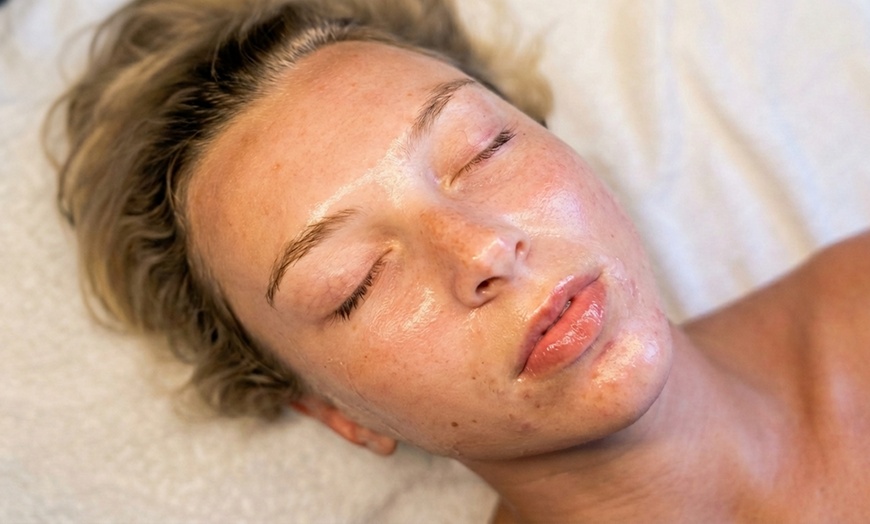 Image 3: One, Two, Three or Four Professional Grade Pro Chemical Peels