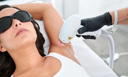Gehele benen - zes laserontharingssessies - House of hair removal