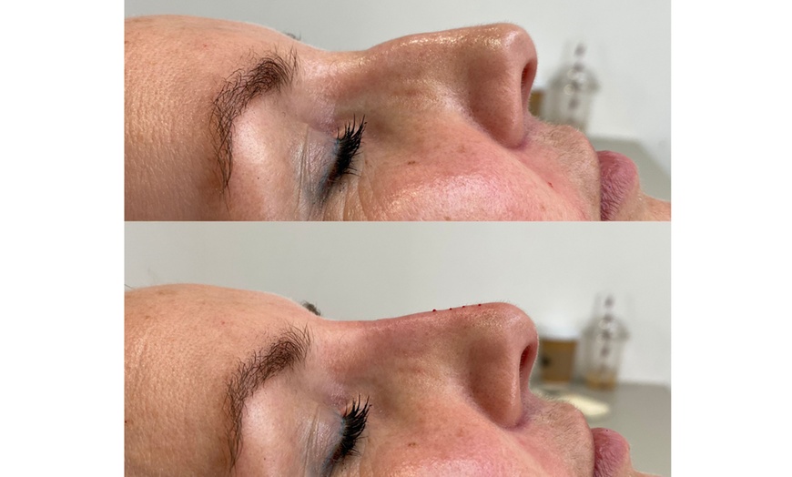 Image 5: Get Smooth Skin with 1, 2, or 3 Dark Circle / Under Eye Treatments