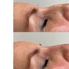 Image 5: Get Smooth Skin with 1, 2, or 3 Dark Circle / Under Eye Treatments