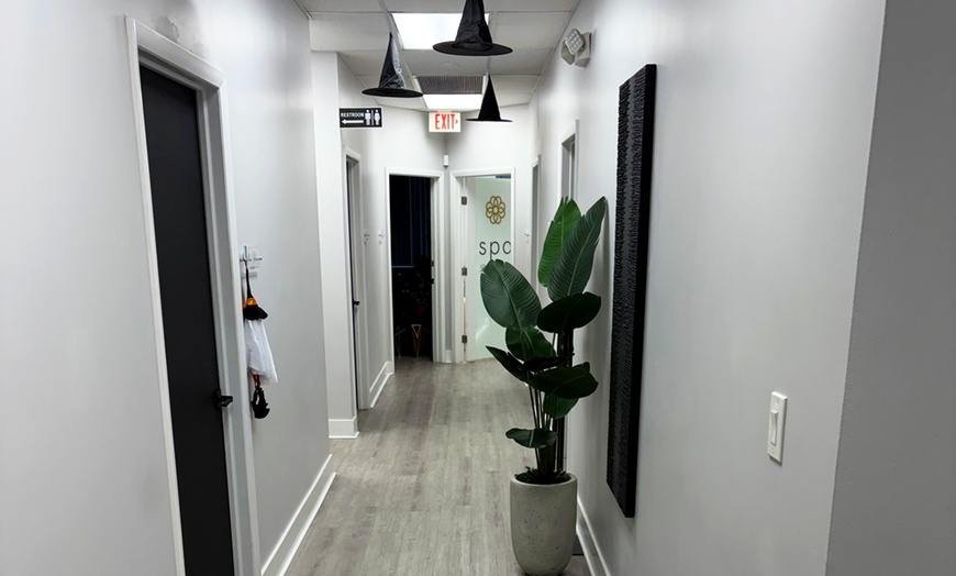 Image 4: Glowing Skin Awaits: PRP Microneedling Packages