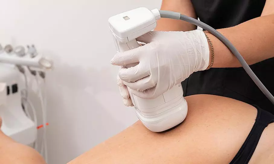 1 o 2 sesiones de liposucción sin cirugía con Focus Shape Pro para 1 persona, ahorra hasta un 72% - Primary Image