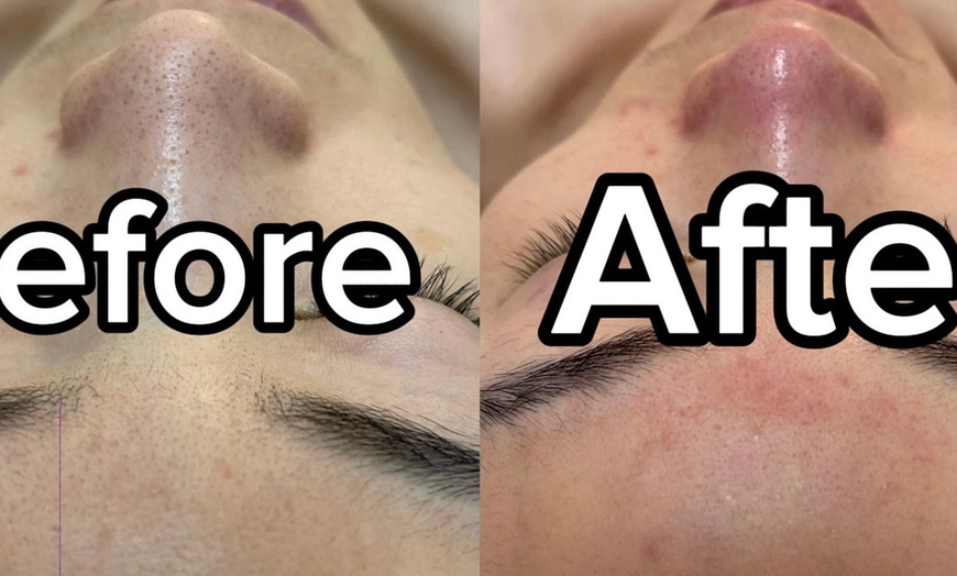 Image 3: 1, 2 or 3 Sessions of Deep Cleaning Facial & Shoulder & Neck Massage