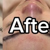 Image 3: 1, 2 or 3 Sessions of Deep Cleaning Facial & Shoulder & Neck Massage