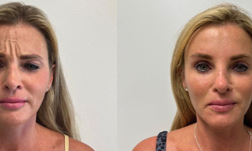 Image 2: Freeze Time & Glow On: Custom Daxxify Treatments for Every Look!
