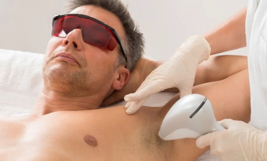Image 2: Up to 50% Off on Laser Hair Removal at High Care Clinic