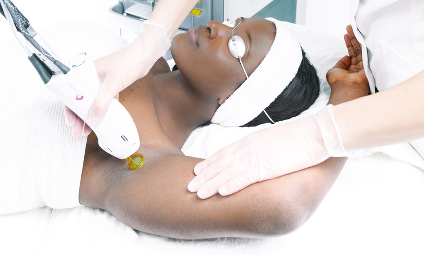 Image 2: Smooth Skin with a Laser Hair Removal Session