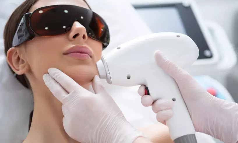 Piel sin manchas con IPL en una o tres sesiones