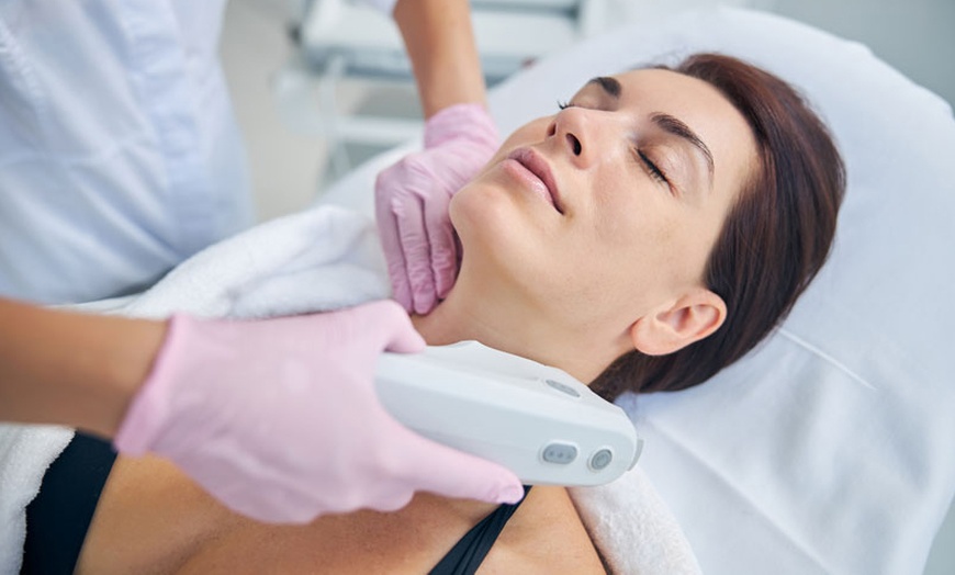 Image 1: Tratamiento HIFU 12D Ultra-lifting con radiofrecuencia 