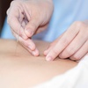 Image 3: Lymphatic Drainage, Acupuncture & Deep Tissue Sessions — Solo / Couple