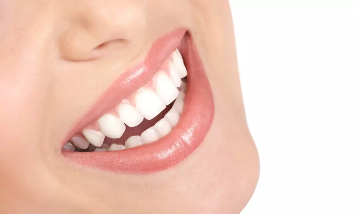 One 20- or 40-Minute LED Teeth-Whitening Session at Faces Medical Spa - Primary Image