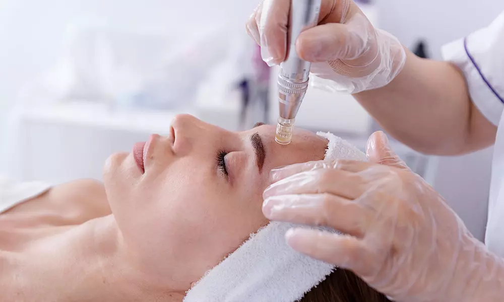 1 o 2 sesiones de microlifting facial con vitaminas con Dermapen