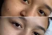 Up to 37% Off on Eyelash Lift and Tint with Optional Eyebrow Shaping at Honeyco. Esthetics - Second Medium