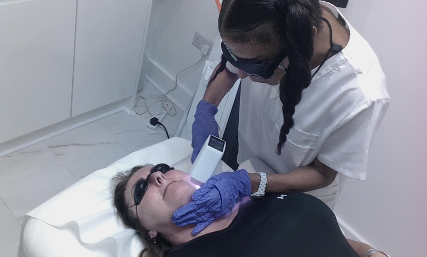 Image 11: 6 Laser Hair Removal Sessions for Small or Large Areas
