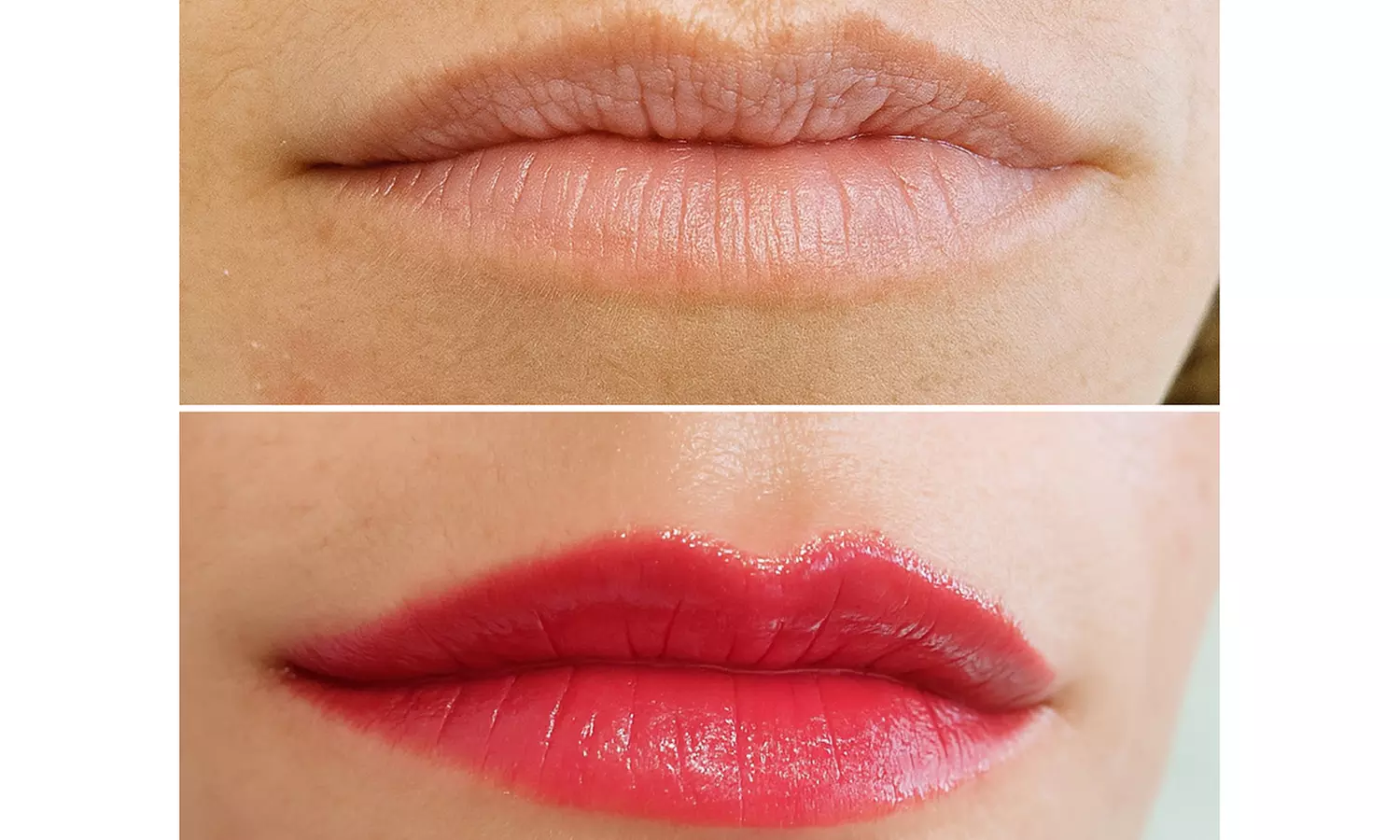 1 o 2 sesiones de Dermapen Hydralips para 1 persona